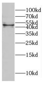 CTBP1 Rabbit Polyclonal Antibody