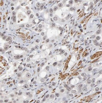 CTBP1 Rabbit Polyclonal Antibody