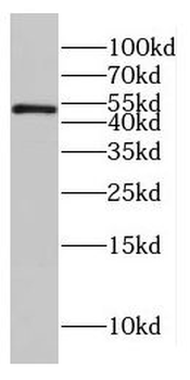 CTBP2 Antibody
