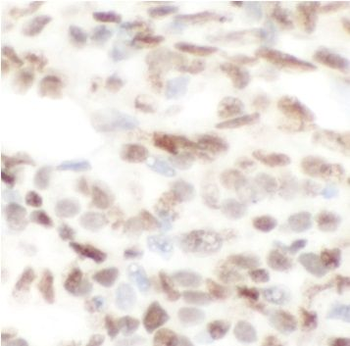CTBP2 Antibody