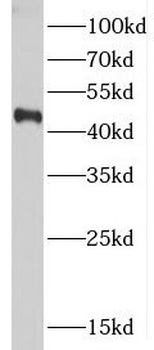 CTBS Rabbit Polyclonal Antibody