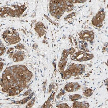 CTBS Rabbit Polyclonal Antibody