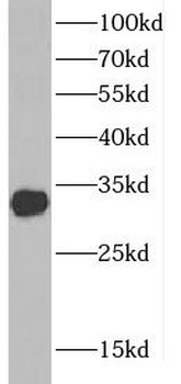 CTDSP1 Rabbit Polyclonal Antibody