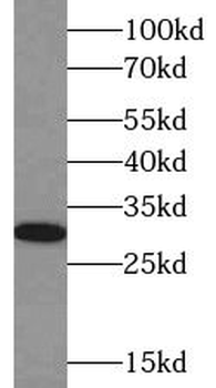 CTHRC1 Antibody