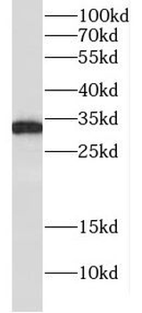 CUEDC2 Rabbit Polyclonal Antibody