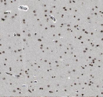 CUEDC2 Rabbit Polyclonal Antibody