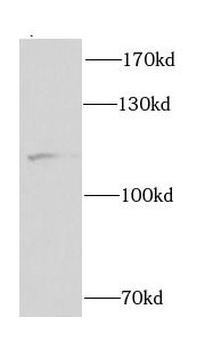 CUL4B Rabbit Polyclonal Antibody