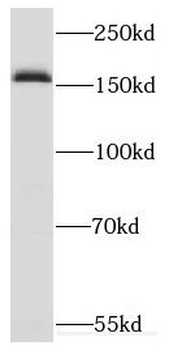 CUX2 Rabbit Polyclonal Antibody