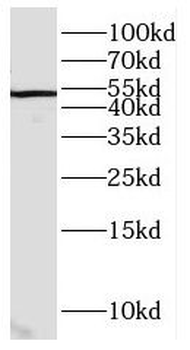 CWC25 Rabbit Polyclonal Antibody