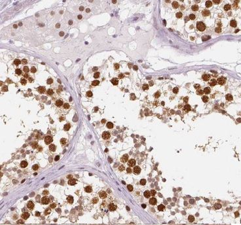 CWC25 Rabbit Polyclonal Antibody