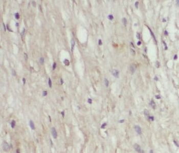 CXCL17 Rabbit Polyclonal Antibody