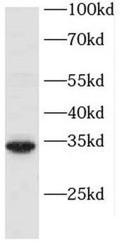 PBDC1 Rabbit Polyclonal Antibody