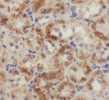 PBDC1 Rabbit Polyclonal Antibody
