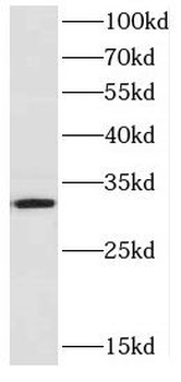 CYB5R3 Rabbit Polyclonal Antibody