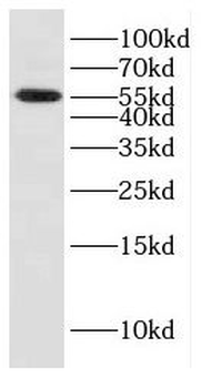 CYB5R4 Rabbit Polyclonal Antibody