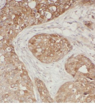 CYC1 Rabbit Polyclonal Antibody