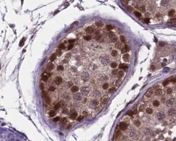 CCNA1 Rabbit Polyclonal Antibody