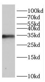 CCND2 Rabbit Polyclonal Antibody
