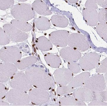 CCND2 Rabbit Polyclonal Antibody