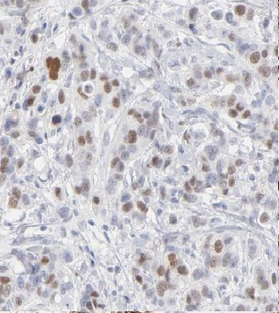 CCNG1 Rabbit Polyclonal Antibody