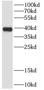 CYLC2 Rabbit Polyclonal Antibody