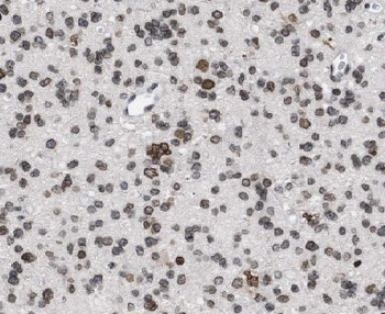 CYLC2 Rabbit Polyclonal Antibody