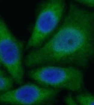 CYP11B2 Rabbit Polyclonal Antibody