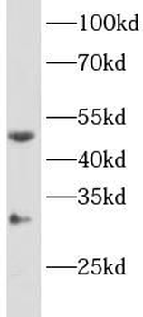 CYP11B2 Rabbit Polyclonal Antibody