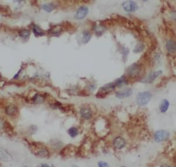 CYP11B2 Rabbit Polyclonal Antibody