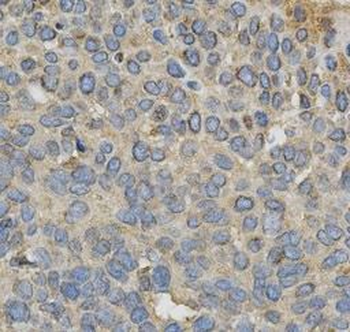 CYP1A1 Rabbit Polyclonal Antibody