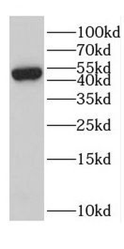 CYP1B1 Rabbit Polyclonal Antibody