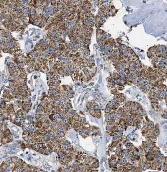 CYP1B1 Rabbit Polyclonal Antibody