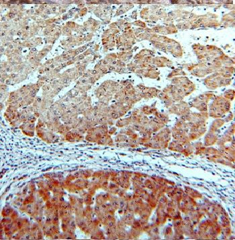 CYP26B1 Rabbit Polyclonal Antibody