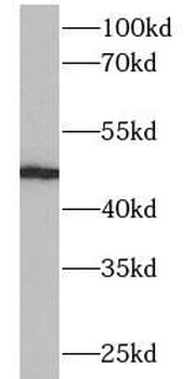 CYP2A6 Rabbit Polyclonal Antibody