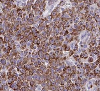 CYP2A6 Rabbit Polyclonal Antibody