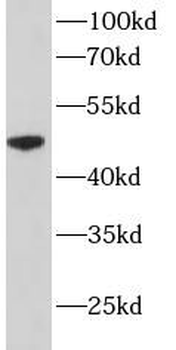 CYP2D6 Rabbit Polyclonal Antibody