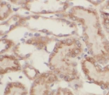 CYP2D6 Rabbit Polyclonal Antibody