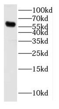 CYP2J2 Rabbit Polyclonal Antibody