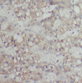 CYP2J2 Rabbit Polyclonal Antibody