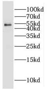 CYP2S1 Rabbit Polyclonal Antibody