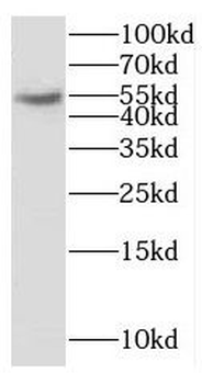CYP2S1 Rabbit Polyclonal Antibody