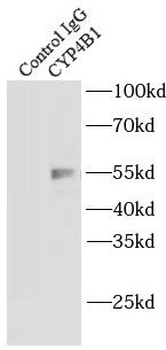 CYP4B1 Rabbit Polyclonal Antibody