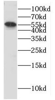 CYP4B1 Rabbit Polyclonal Antibody