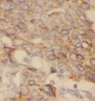 CYP4B1 Rabbit Polyclonal Antibody