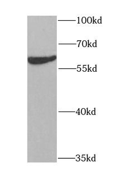 CYP51A1 Rabbit Polyclonal Antibody
