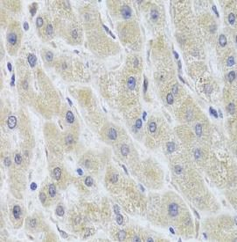 CYP51A1 Rabbit Polyclonal Antibody
