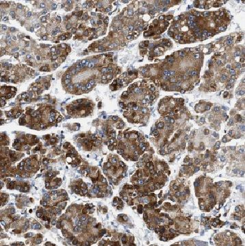 CYP7B1 Rabbit Polyclonal Antibody