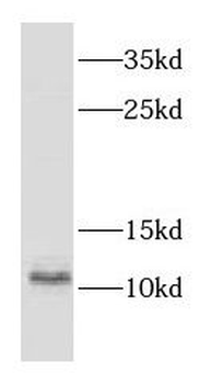 CSTB Rabbit Polyclonal Antibody