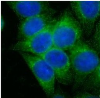 CST3 Rabbit Polyclonal Antibody
