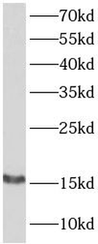 CST3 Rabbit Polyclonal Antibody